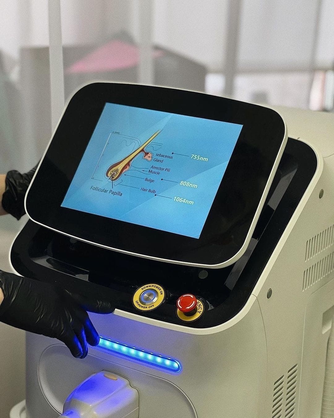 Лазерная эпиляция. 